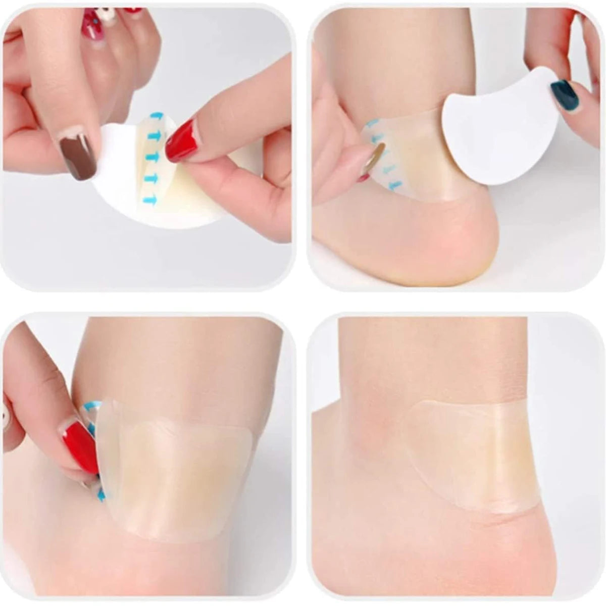 Curativos Invisíveis para Bolhas nos Pés – Gel Hidrocolóide, Kit 15 ou 18 Unidades