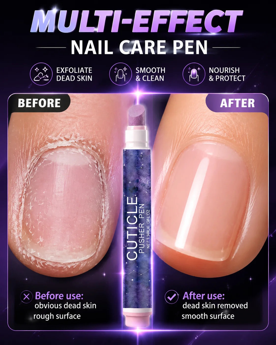 Caneta Multifuncional para Tratamento de Cutículas e Bordas das Unhas – Limpeza Diária e Acabamento