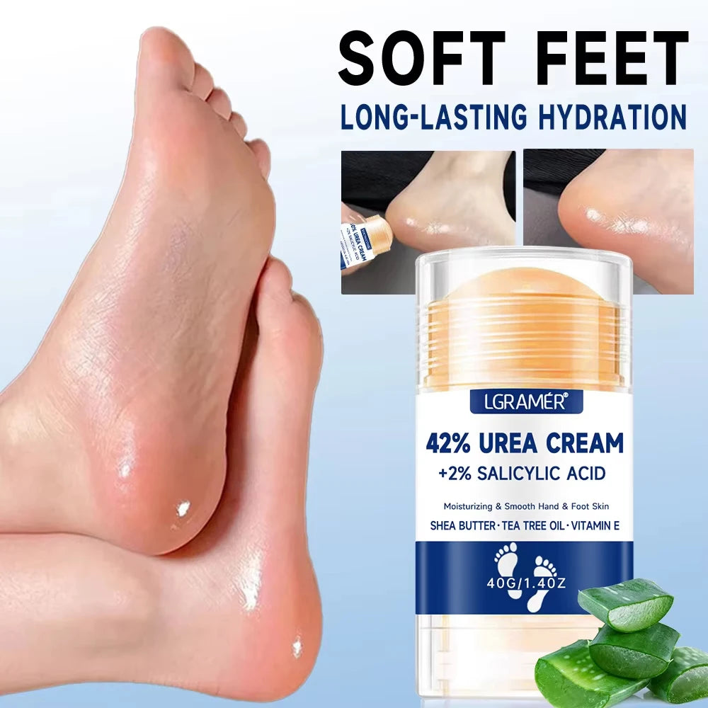 Creme Intensivo para Pés e Mãos com 42% de Ureia e Ácido Salicílico – Hidratação Profunda para Pele Seca e Rachada