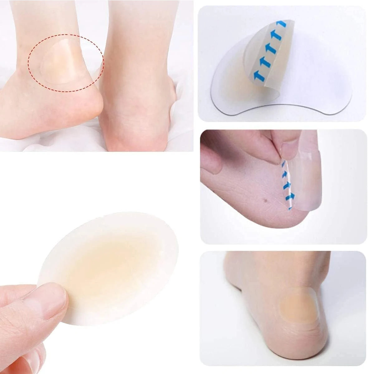 Curativos Invisíveis para Bolhas nos Pés – Gel Hidrocolóide, Kit 15 ou 18 Unidades