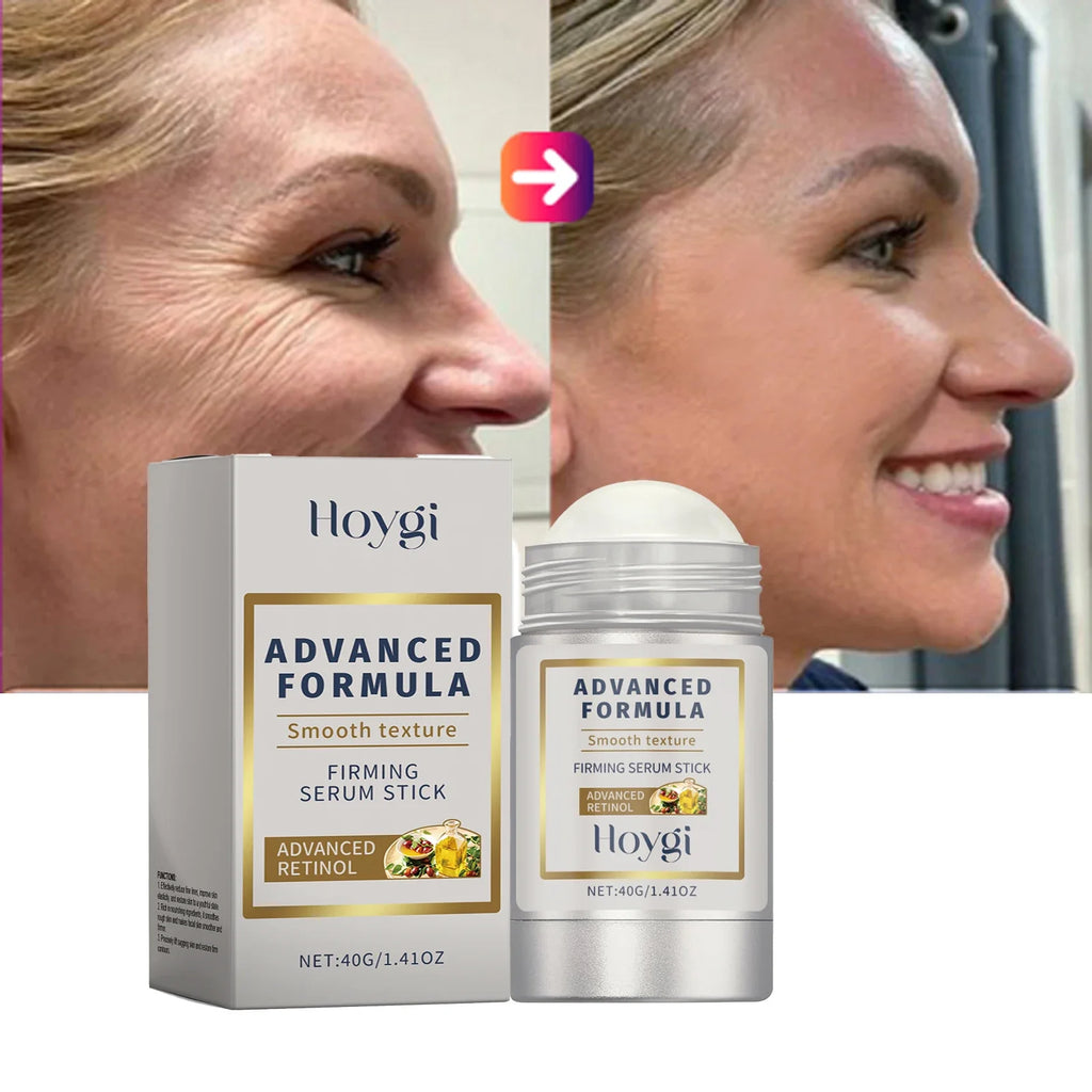 Bastão Facial com Retinol e Ácido Hialurônico – Anti-Rugas, Afina Poros, Firmeza e Hidratação 24h