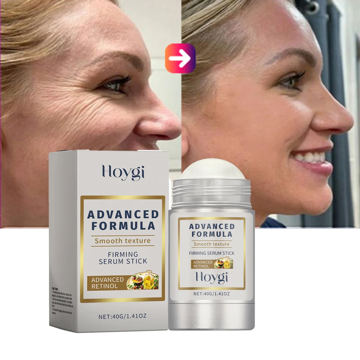 Bastão Facial com Retinol e Ácido Hialurônico – Anti-Rugas, Afina Poros, Firmeza e Hidratação 24h