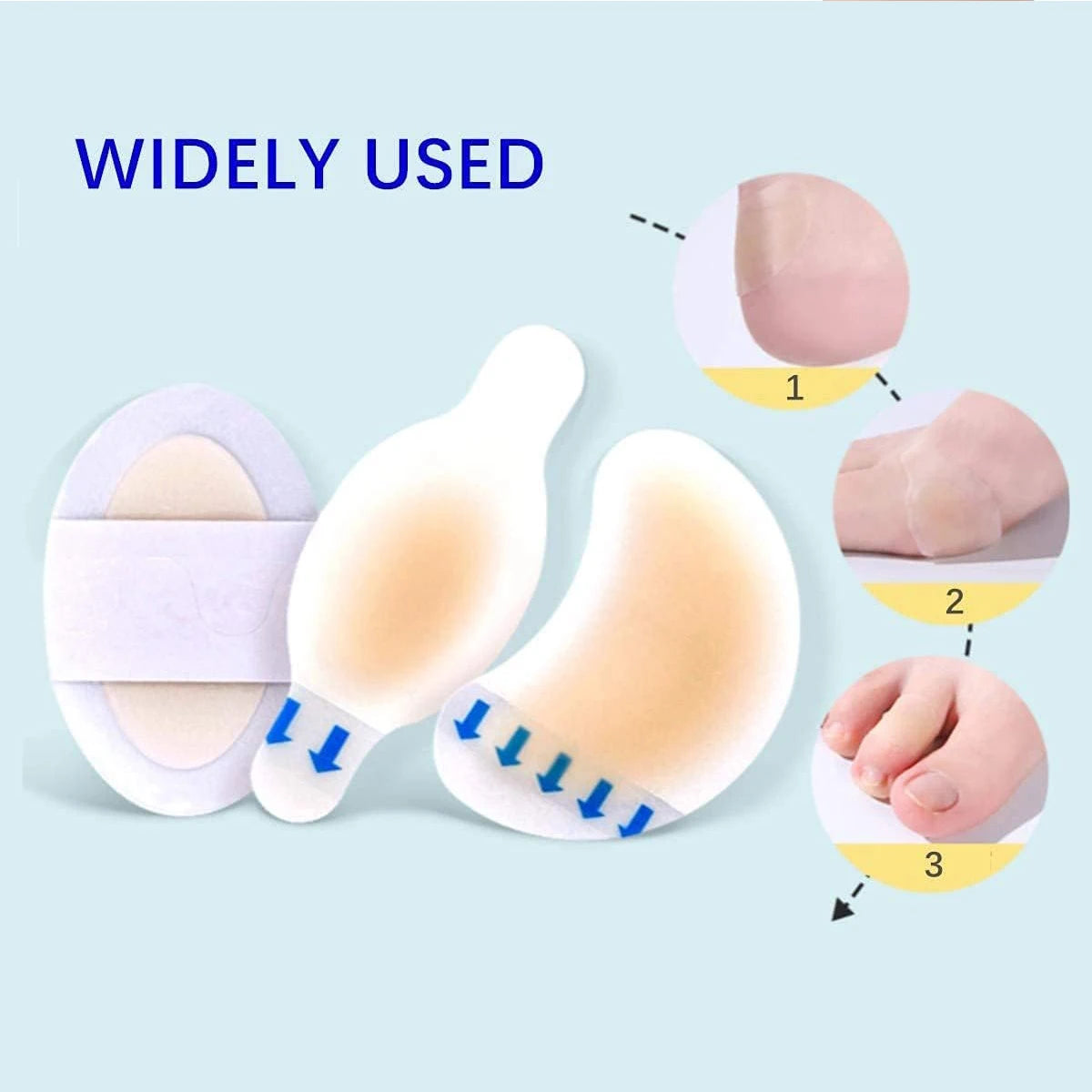 Curativos Invisíveis para Bolhas nos Pés – Gel Hidrocolóide, Kit 15 ou 18 Unidades