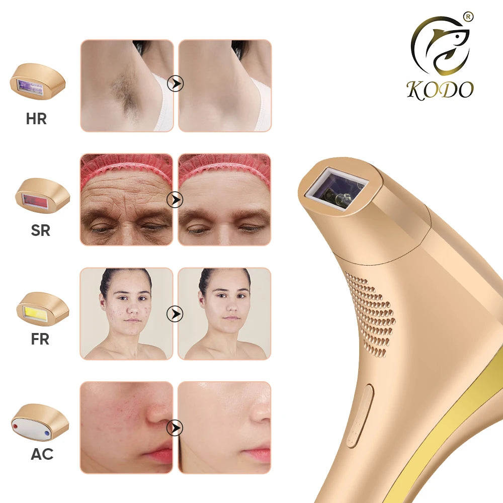 Depilador a Laser IPL 4 em 1 – Redução Duradoura de Pelos, Rosto e Corpo